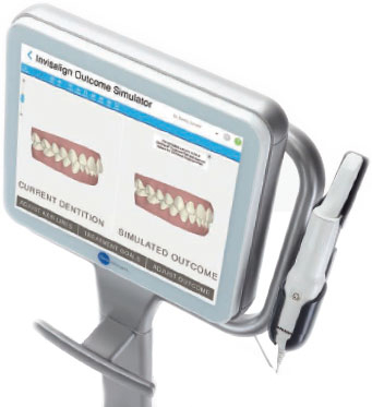 Invisalign Intraoral Camera